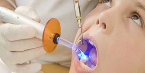 dental-filling