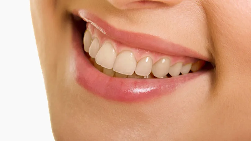 dentist-before
