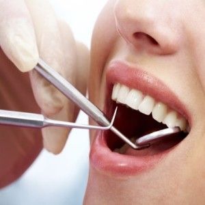 Teeth Scaling